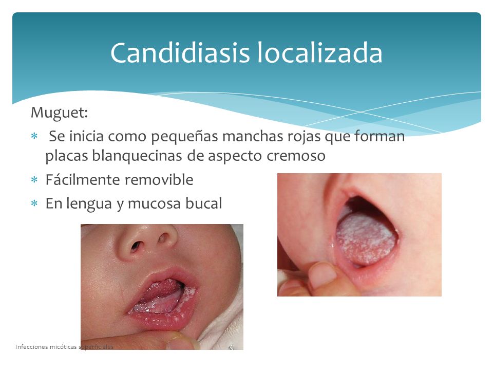manchas rojas infección micótica manchas rojas infección micótica